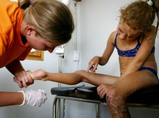 Оказват помощ на дете, пострадало от медуза в Салобрена в югоизточна Испания