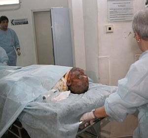 Трима от ранените ще бъдат оперирани в ”Пирогов”, ако състоянието им позволи интервенция