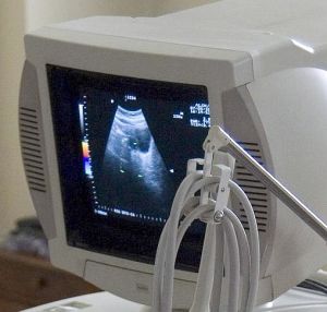 Безплатен скрининг за бъдещи майки