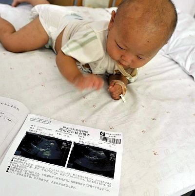Китайско бебе, пило от опасното мляко с меламин