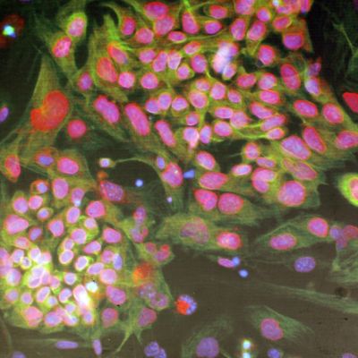 Досега се смяташе, че най-малките многоклетъчни организми включват не по-малко от 10 клетки (сн. архив)