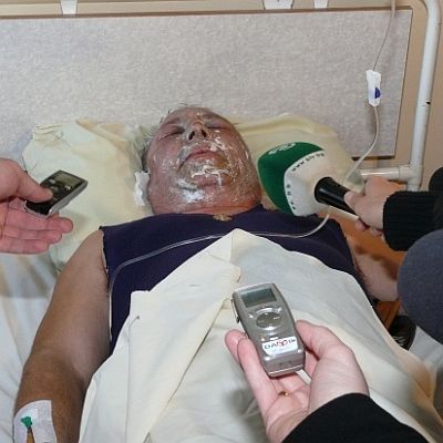 Сега пък заляха бизнесмен с киселина