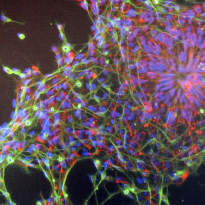 Над 2000 съхраняват стволови клетки