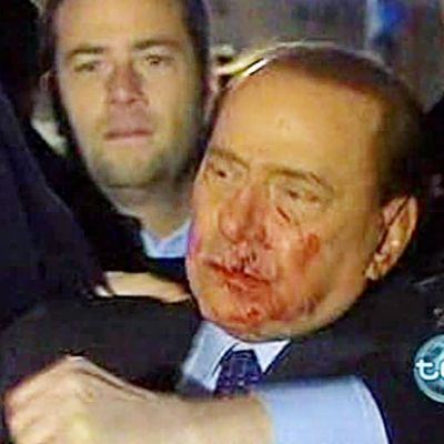 Берлускони получи удар в лицето