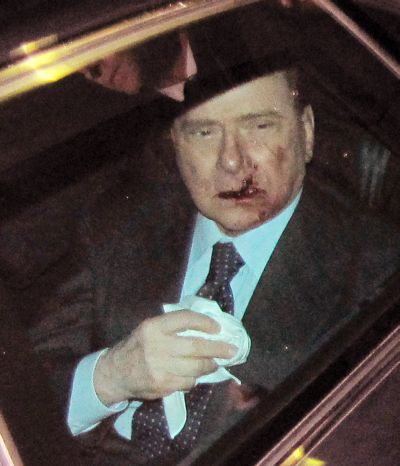 Силвио Берлускони бе откаран със служебната си кола в болница