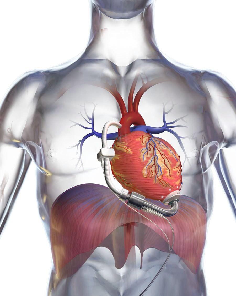Учени ще създават човешко сърце с 3D принтер