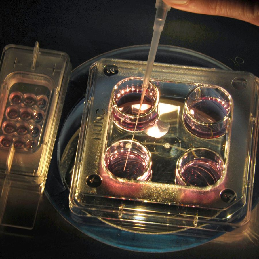 Учените отдавна експериментират със създаването на сперматозоиди и яйцеклетки по изкуствен път