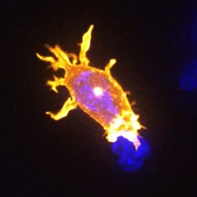 T-лимфоцит бавно поглъща ракова клетка