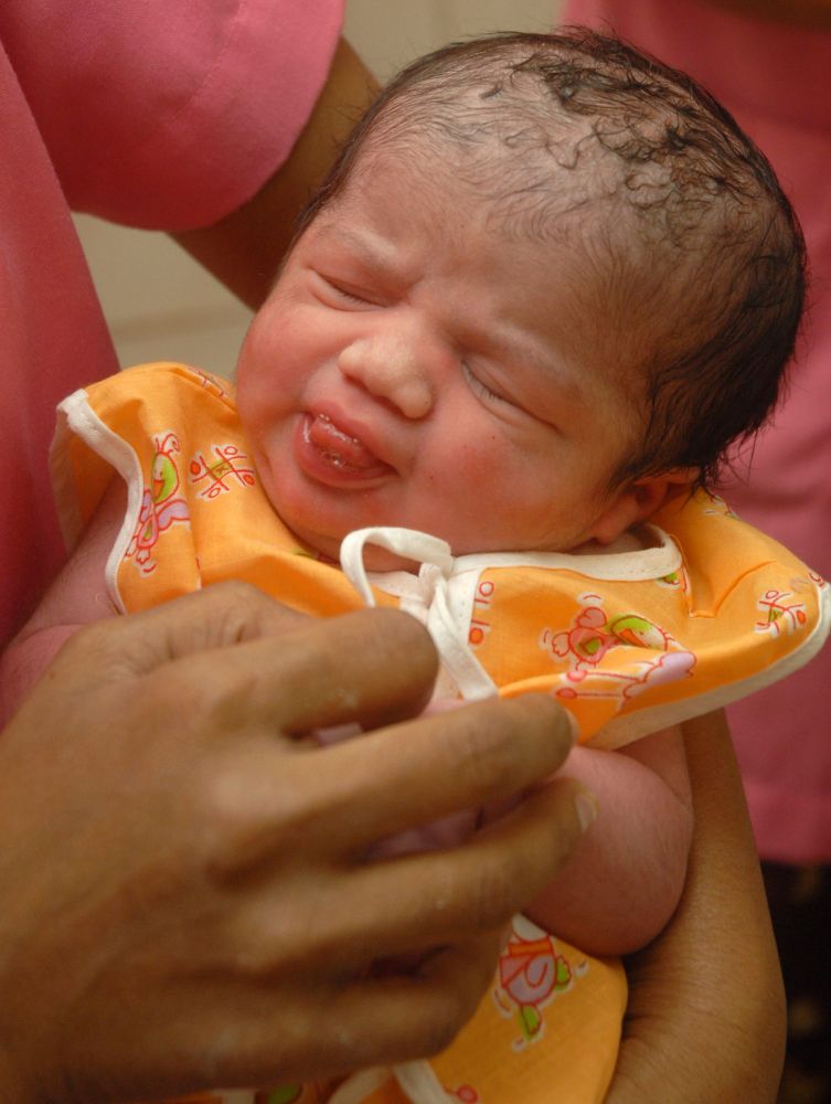 Рязко нараснa броят на новородените в Бразилия с признаци на микроцефалия