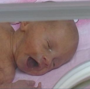 Парализирана жена роди близнаци във Велико Търново
