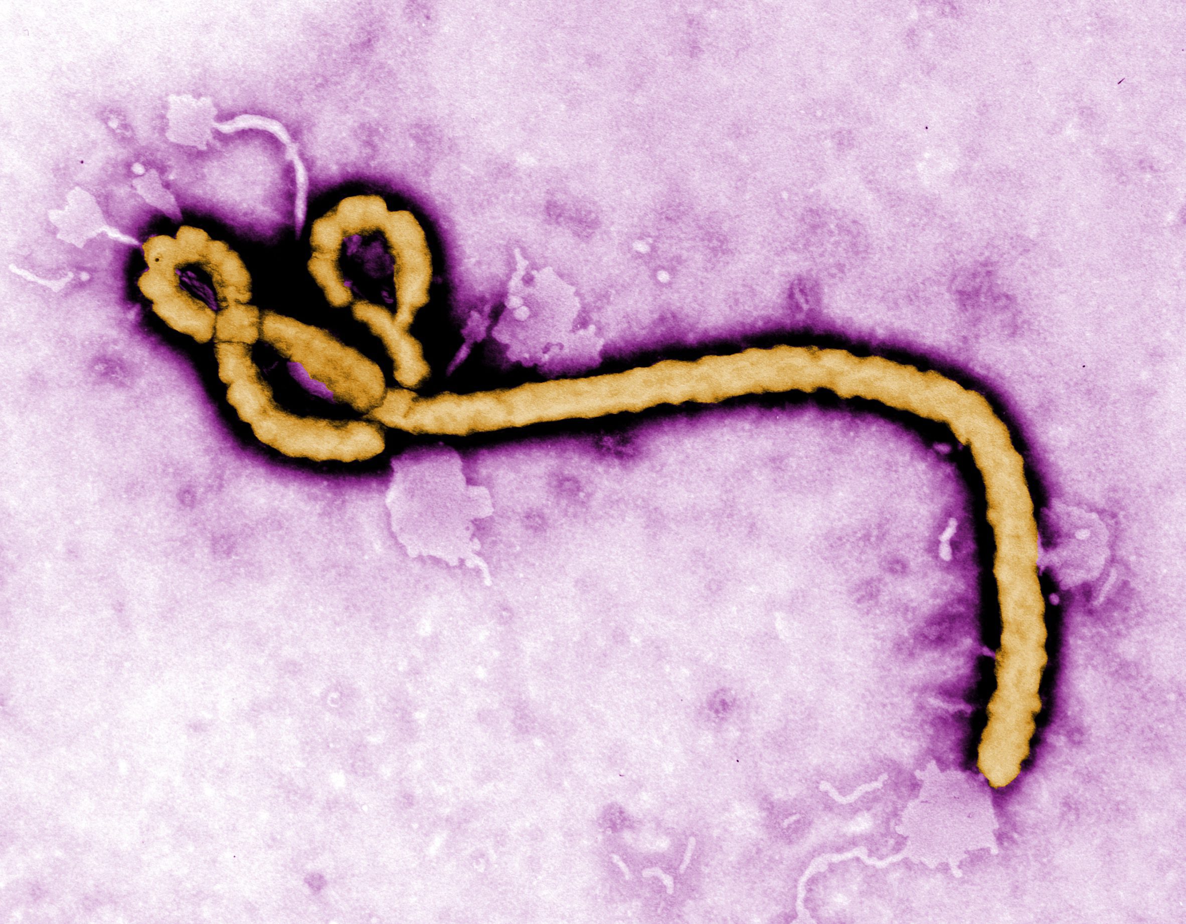 Експерт на СЗО се е заразил с ебола