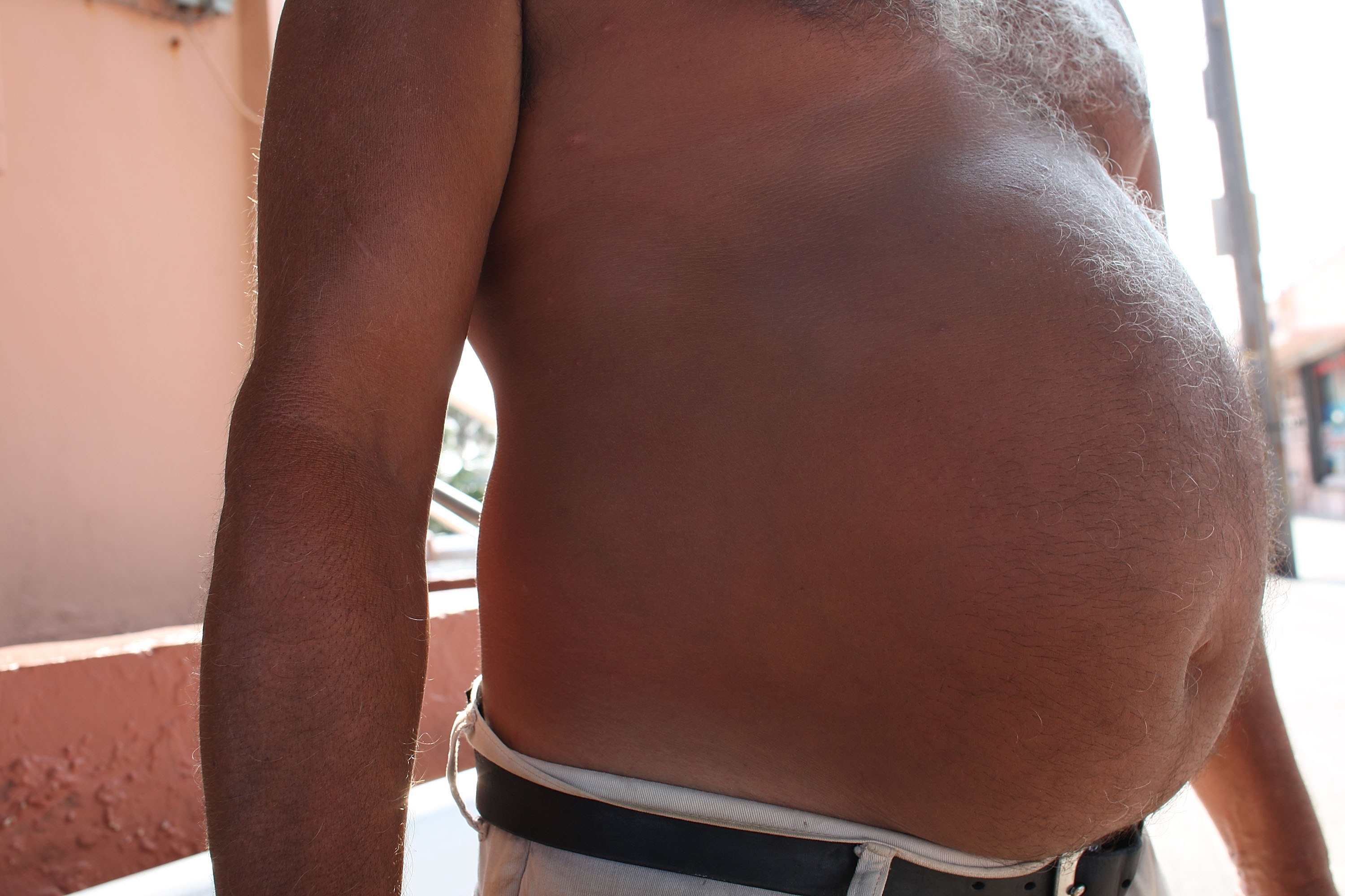 Затлъстяването при мъжете влияе неблагоприятно на зачеването
