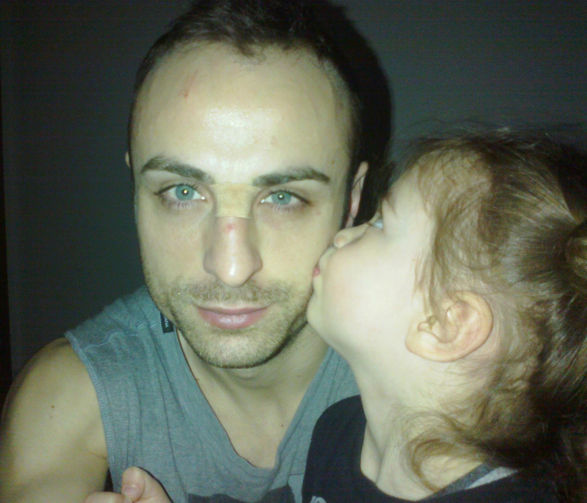 Деа целуна Бербатов за по-бързо оздравяване