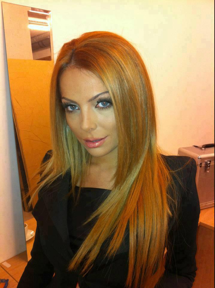 Златка Райкова с пластична операция на лицето