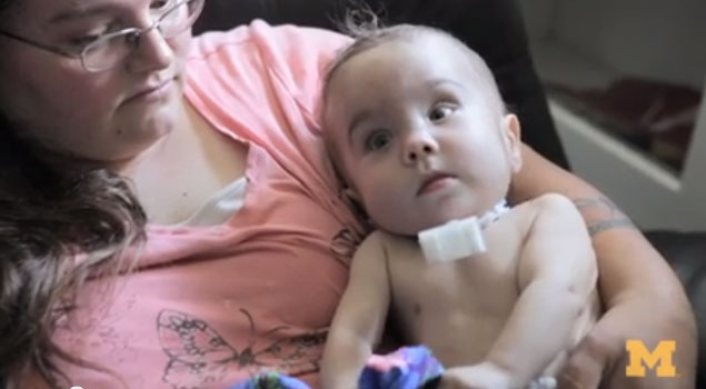 Спасиха живота на бебе с 3D принтер (видео)