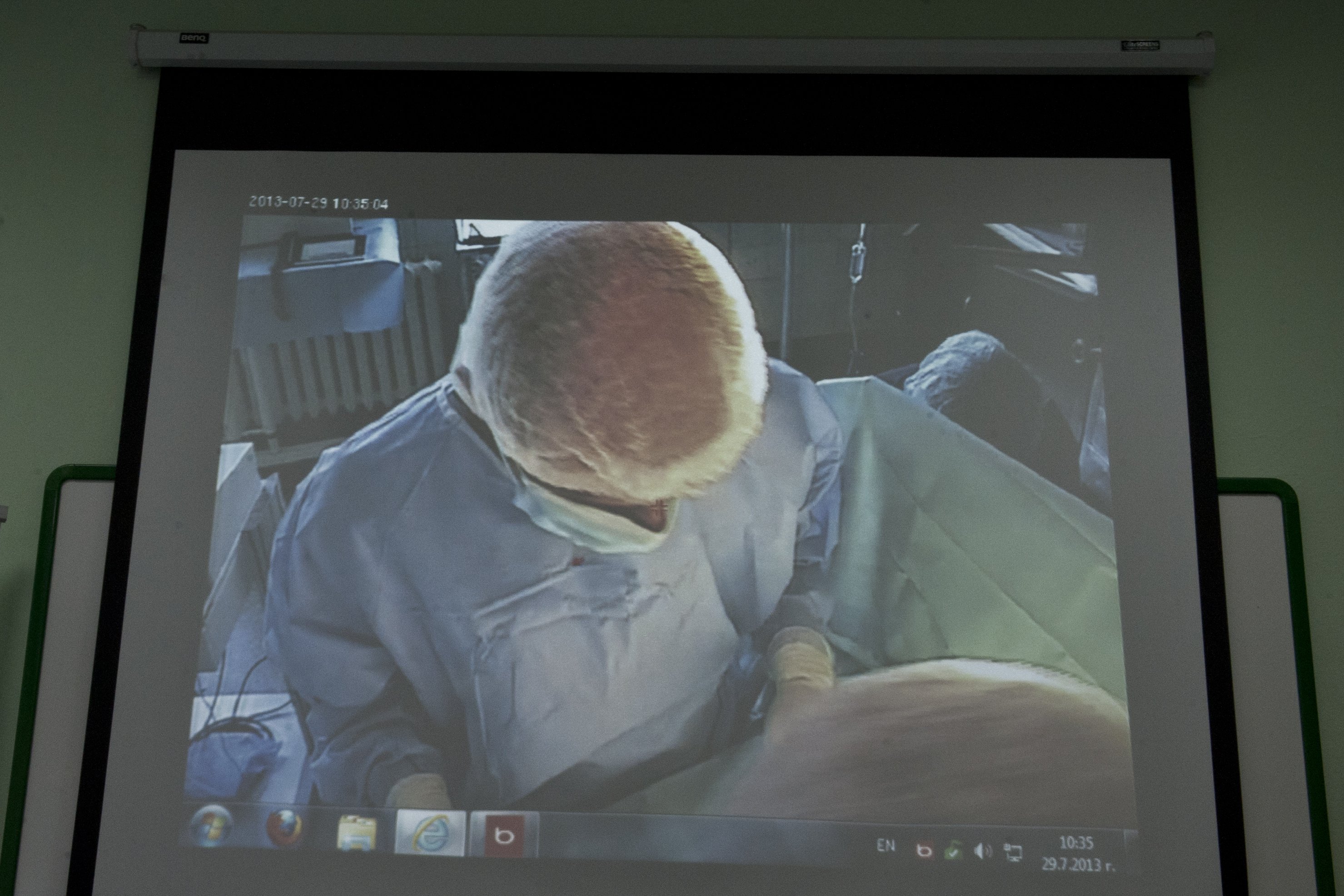 Уникална операция на рак на гърдата чрез телемост между 3 болници