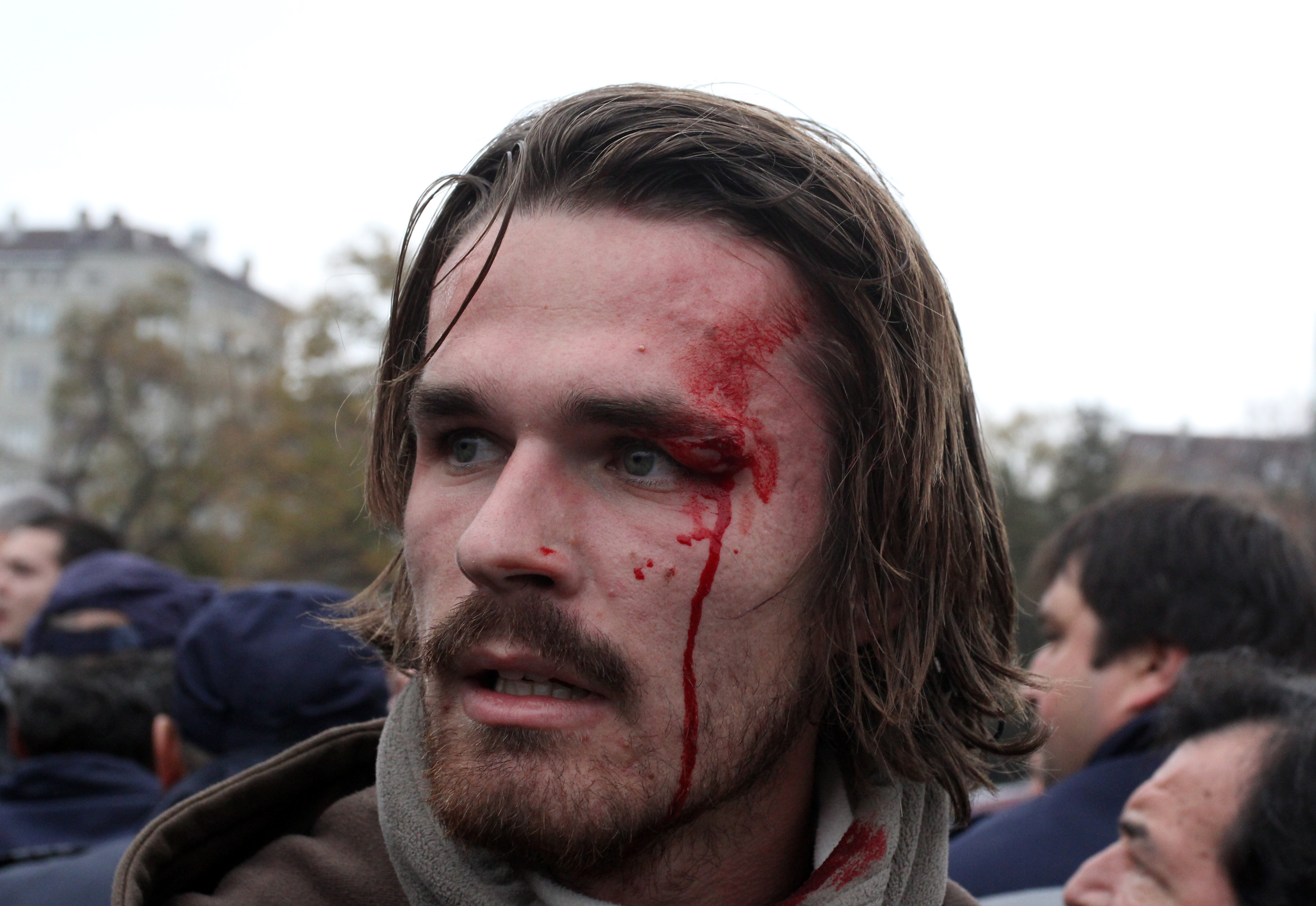 През ноември снимката на ранен при протестите студент обиколи света, но според ”опорните точки” на БСП той не бил добре с глават