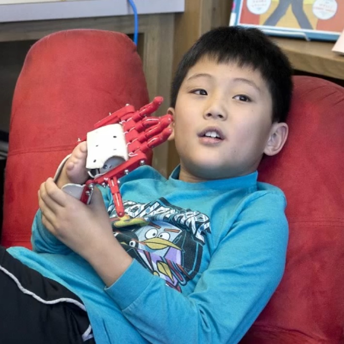 9-годишният Матю ползва 3D-принтираната ”робо ръка” от няколко месеца