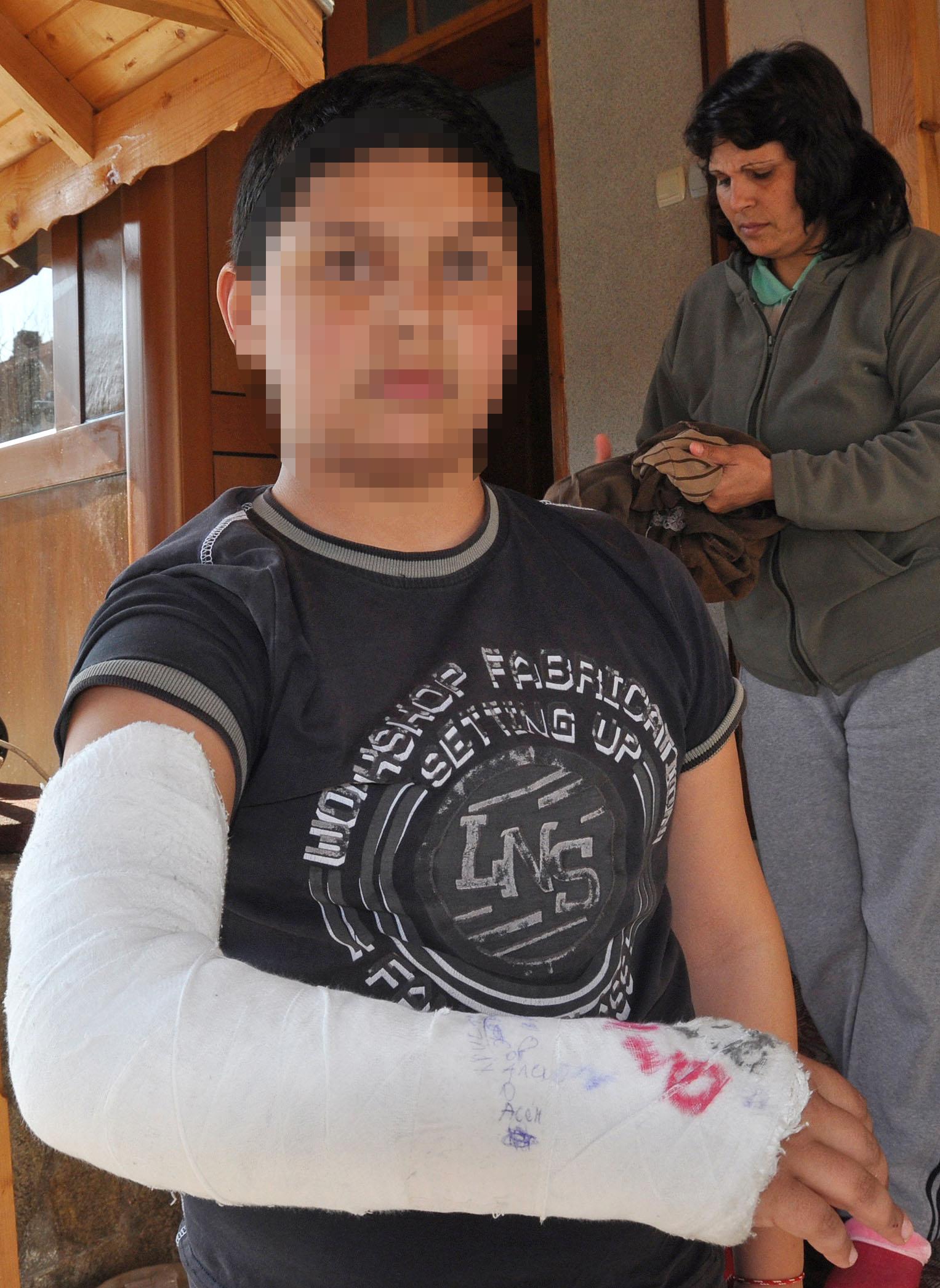 Учителка счупи с дръжка от метла ръката на петокласник