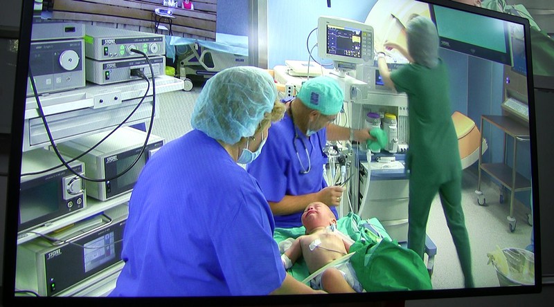 Уникална операция на бебе без ноздра