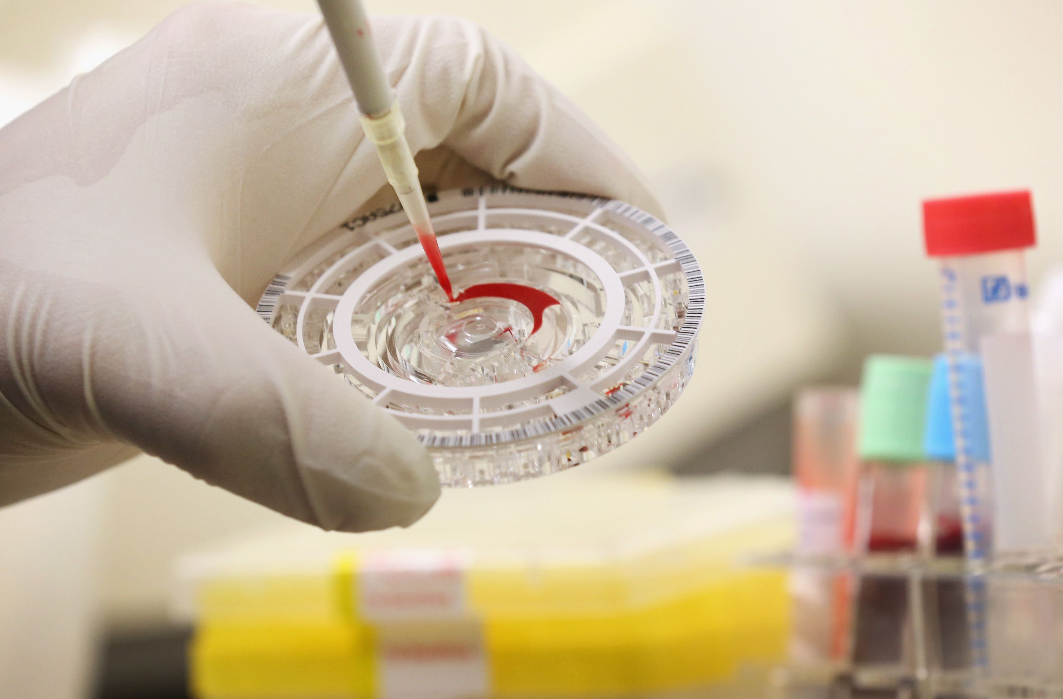 Пациент с подозрения за Ебола е хоспитализиран в Полша