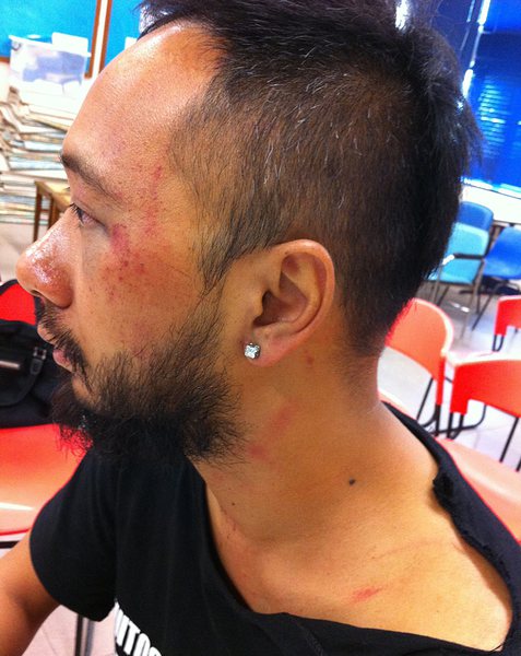 Кен Цанг, член на Гражданската партия, е сред ранените в Хонконг