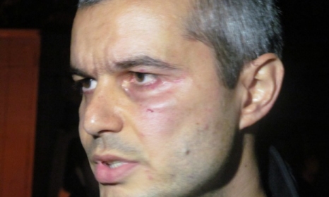 Общинският съветник Костадин Костадинов, който бе ударен от Веселин Марешки