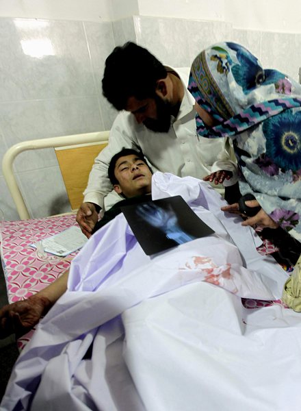 Момче, ранено при атаката на талибаните против училище в Пешавар