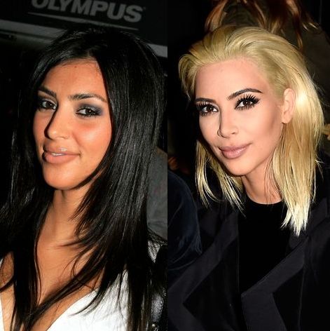 Вижте как лицето на Ким се промени през годините