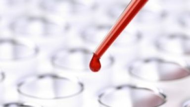 Кръвен тест показва риск от прееклампсия по време на бременност