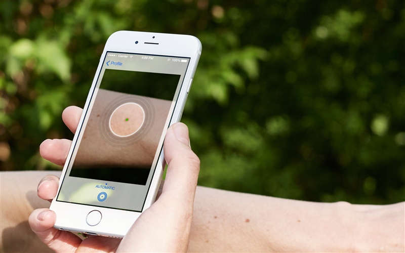 SkinVision открива с 83% точност имате ли рак на кожата