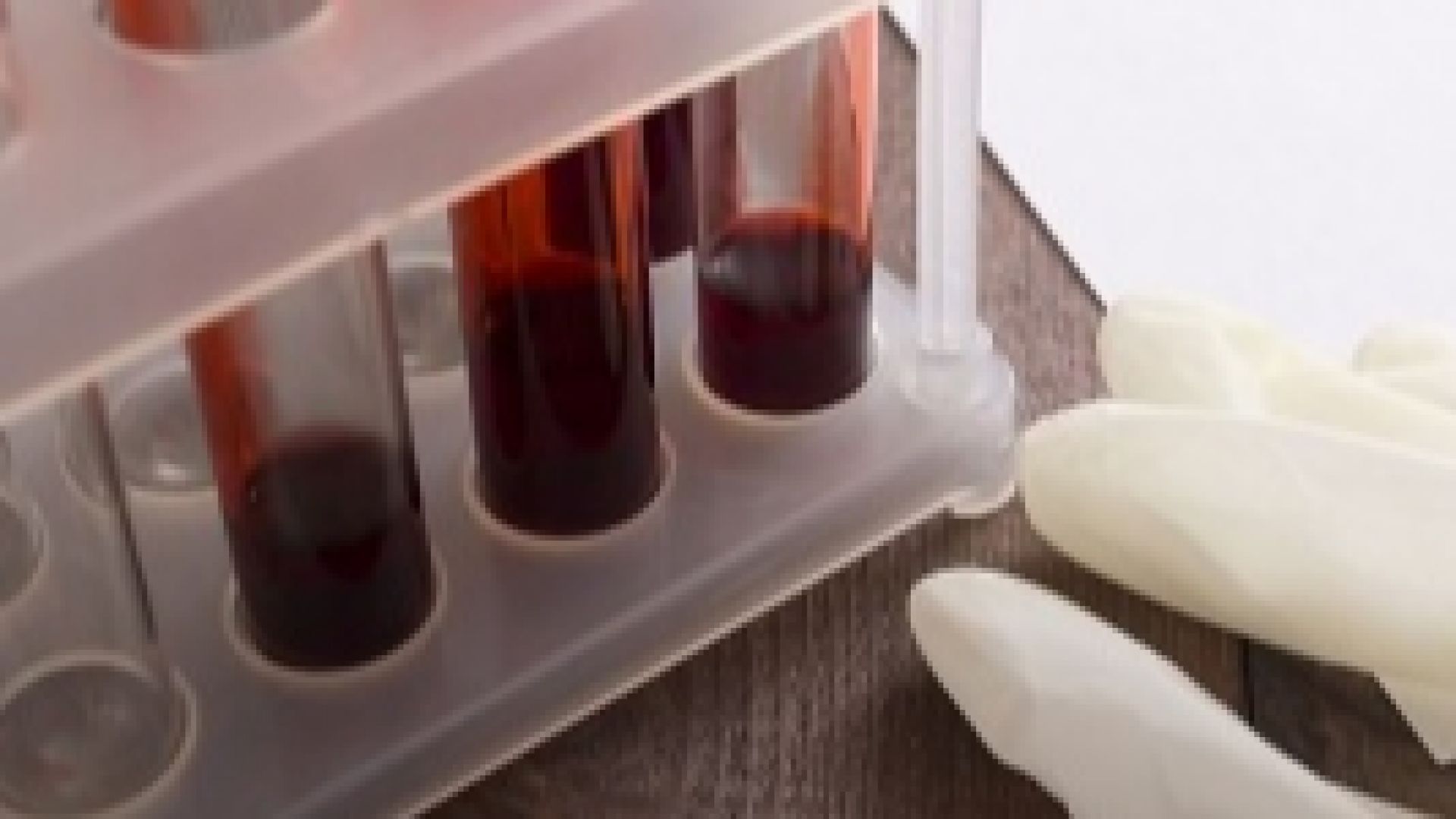 Пациентите намаляват а разходите за химиотерапия се увеличават В същото