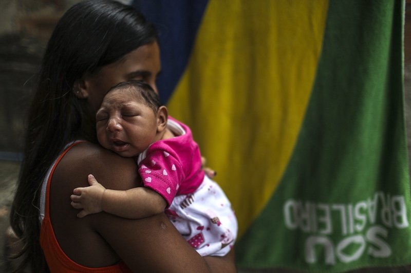 Бразилска майка държи едномесечната си дъщеричка, родена с микроцефалия заради Зика