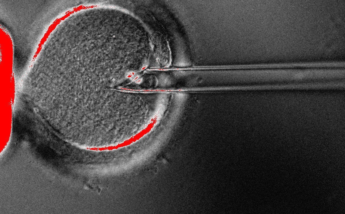 Експерименталната технология комбинира ДНК от две жени и от мъж, за да се избегне предаване на наследствени болести от майката