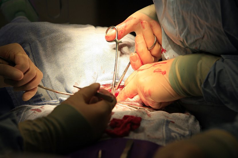 Трансплантацията на черния дроб е извършена в Университетската болница „Лозенец“ (Сн. Архив)