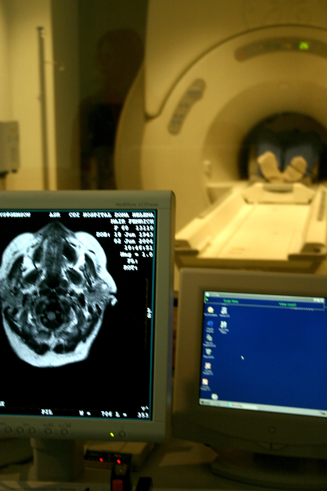 Имунотерапия пребори смъртоносен рак на мозъка