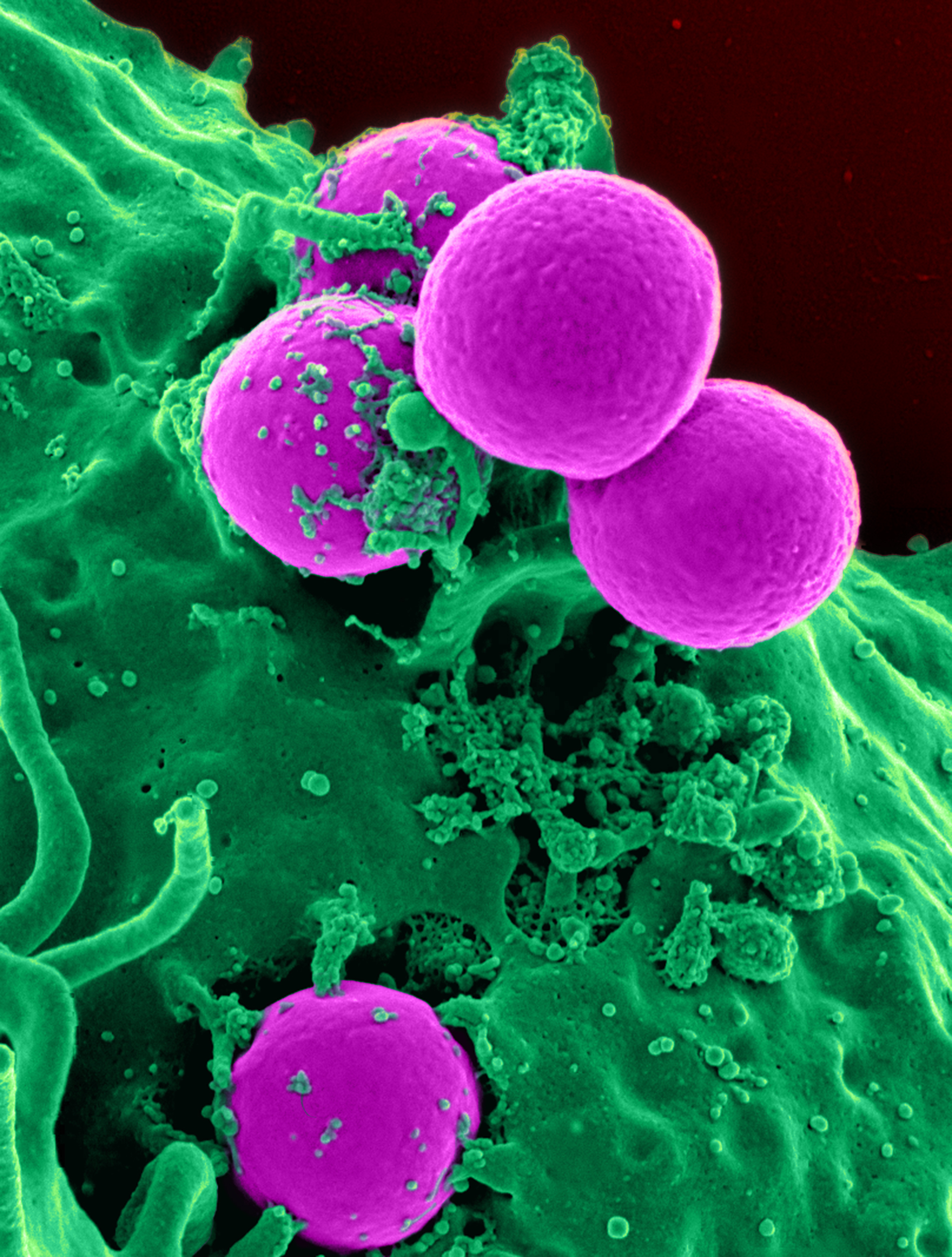 Така изглежда Staphylococcus aureus под микроскоп