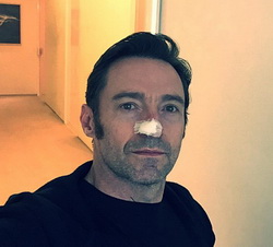 Хю Джакман отново се бори с рака