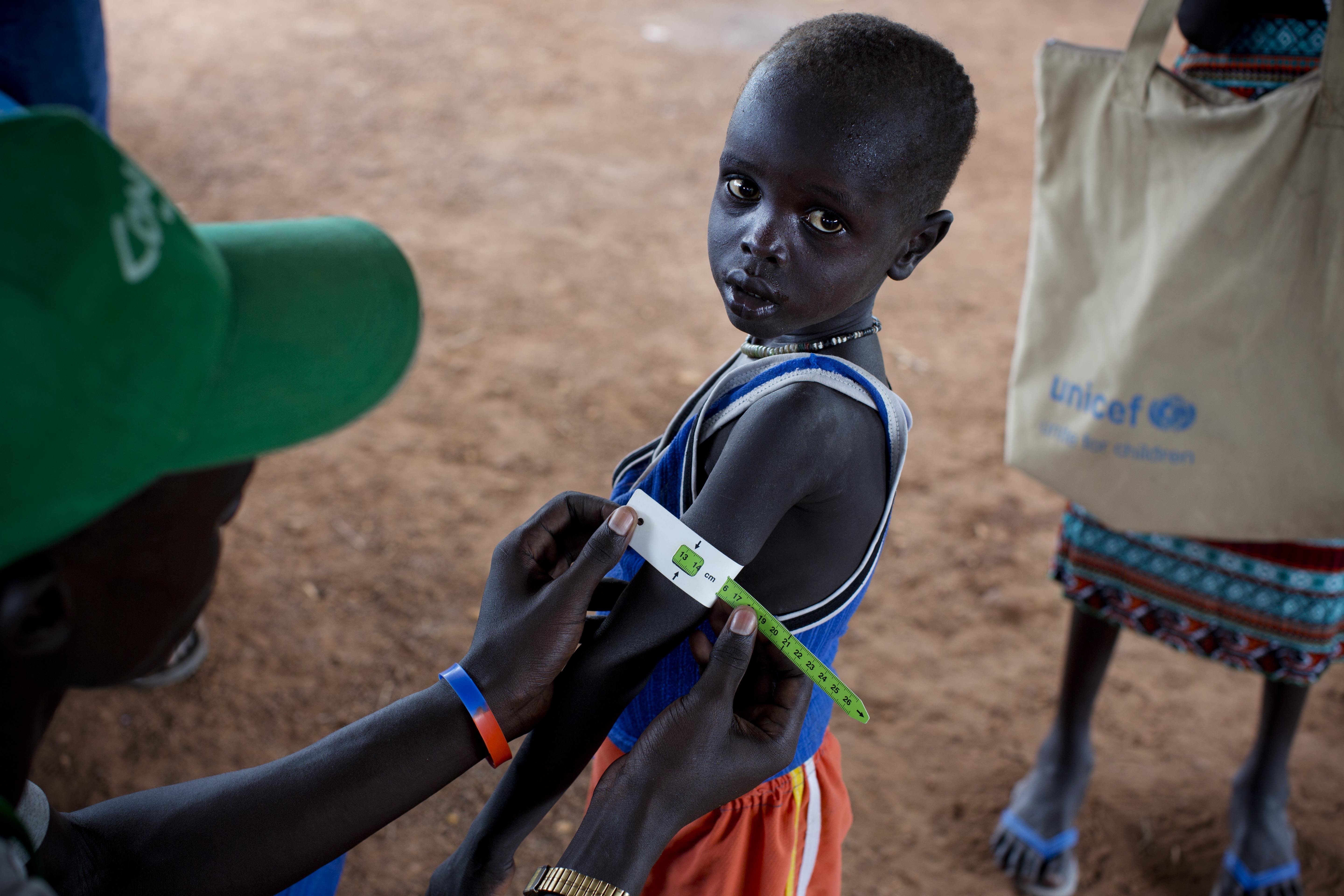 Недохранено дете в Южен Судан (архивна снимка, октомври 2016 г.)