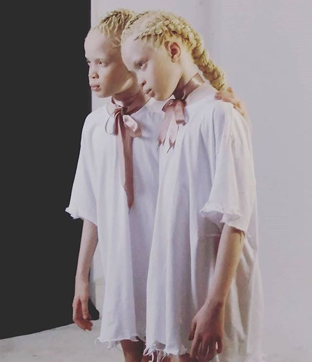 Близначки албиноси превземат модния свят