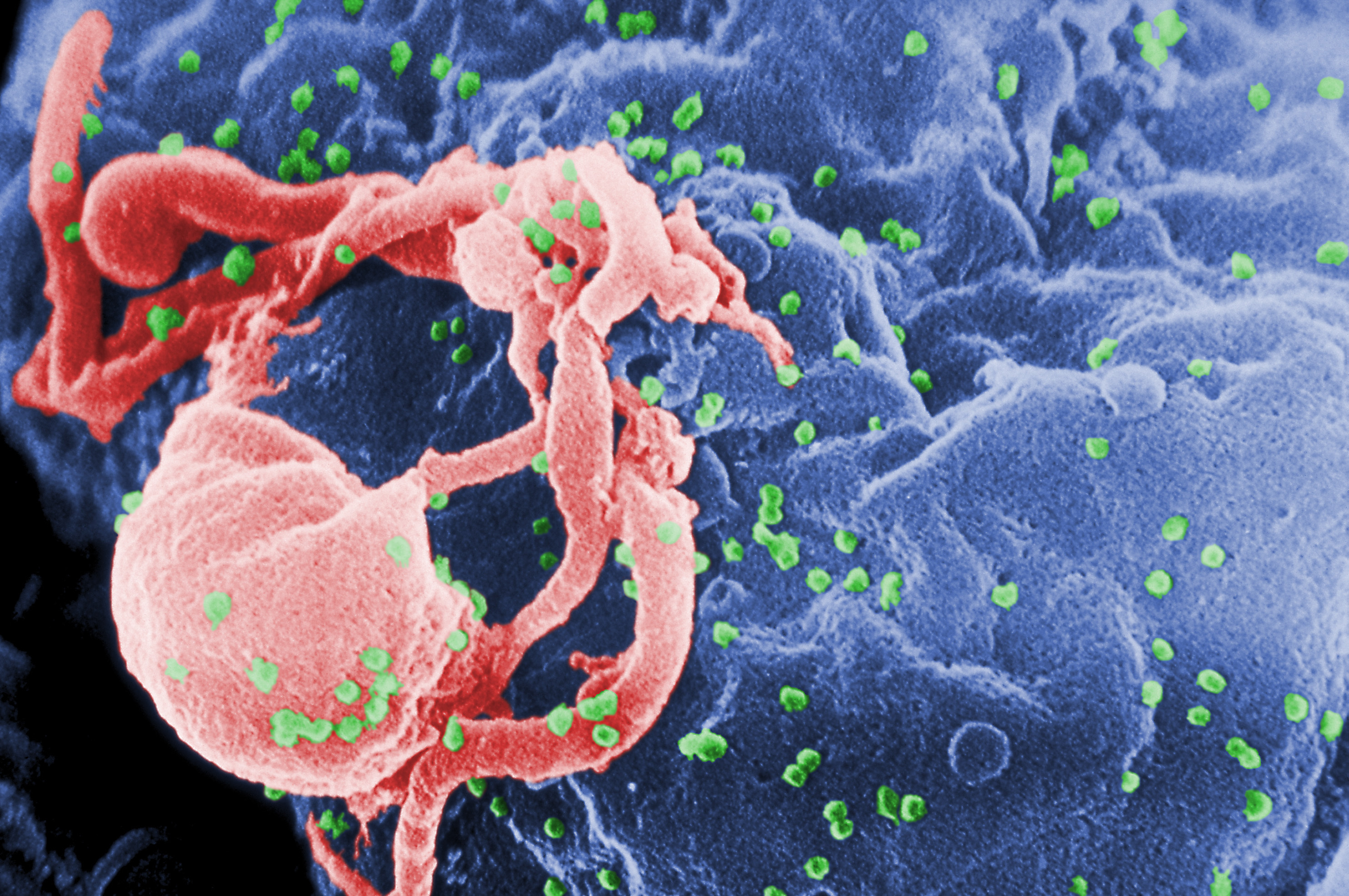 Снимка, която изобразява ХИВ вируса по повърхността на клетките