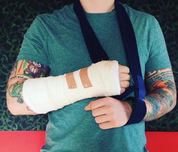 Ед Шийран със счупена ръка след инцидент с колело в Лондон
