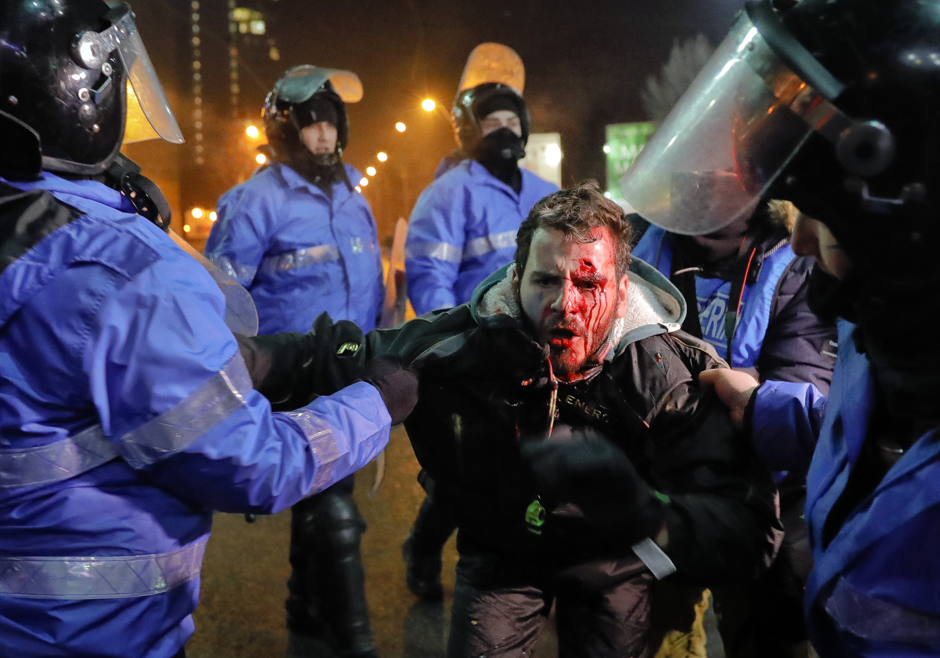 Ранен при протест срещу реформи на правитеството в Румъния