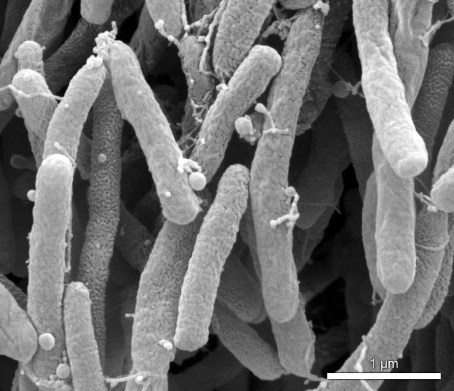 Супербактерия може да унищожи растенията