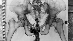 Рентгеновият художник SHOK-1 се завърна още по-атрактивен