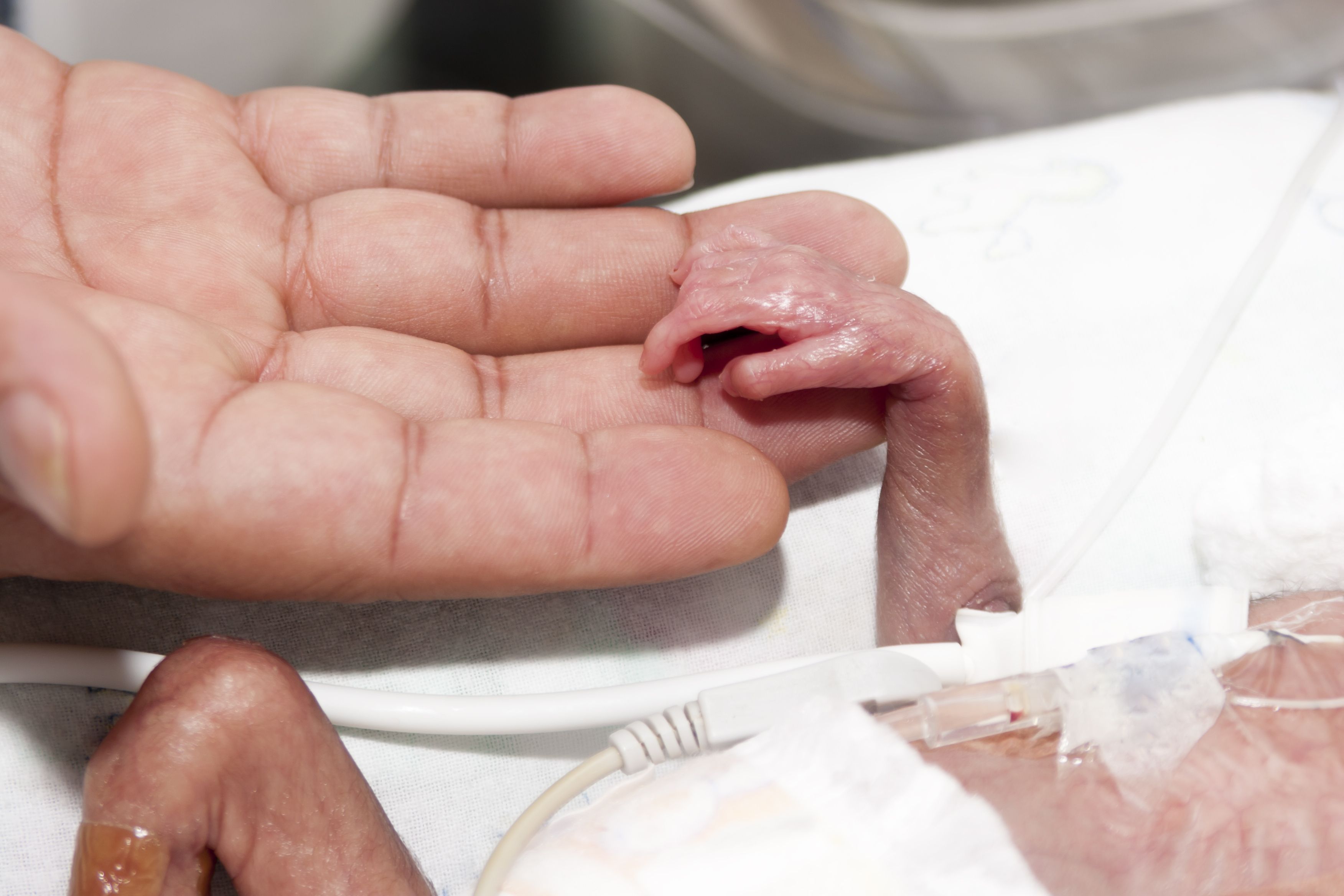 Бебетата, родени много рано, не могат да оцелеят без дихателно подпомагане