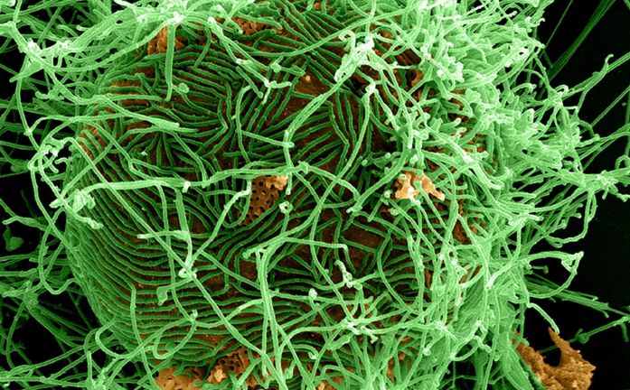 Вирус на Ебола, един от най-смъртоносните в света