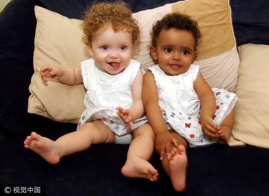 Близначките с различен цвят на кожата Марсия и Мили Бигс