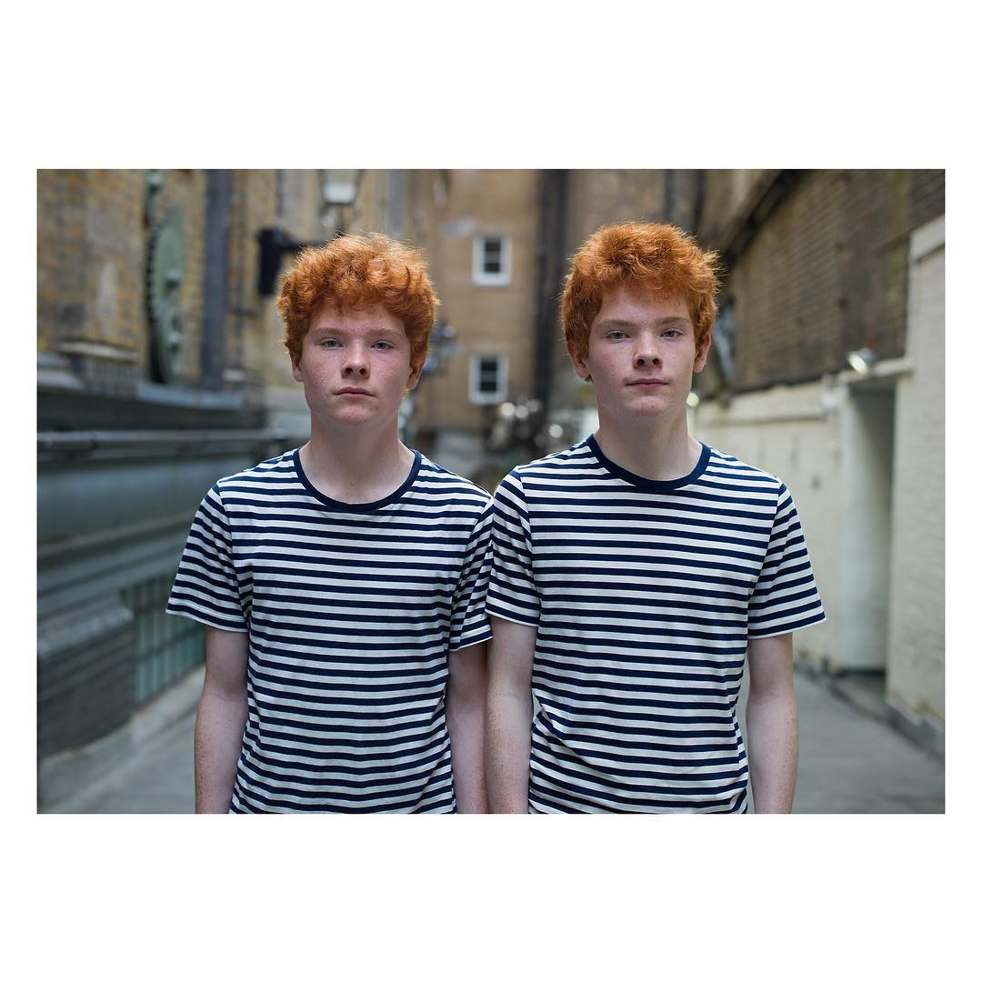 Еднояйните близнаци, които са толкова различни в проекта на Питър Зелевски
