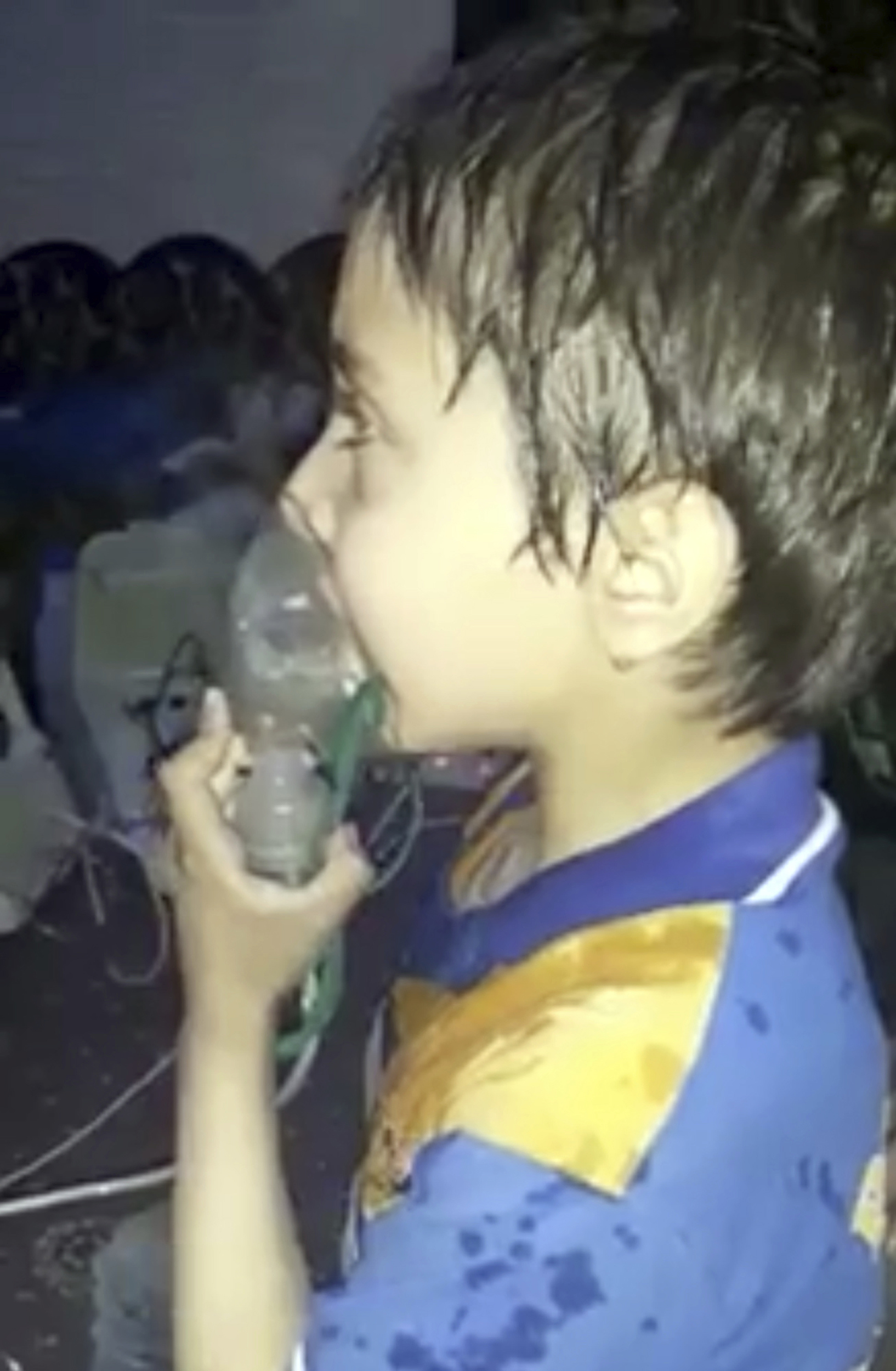 Дете с кислородна маска след предполагаемата газова атака в Дума